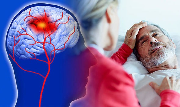 Ar sugebėtumėte atpažinti insultą? Kokie insulto požymiai?