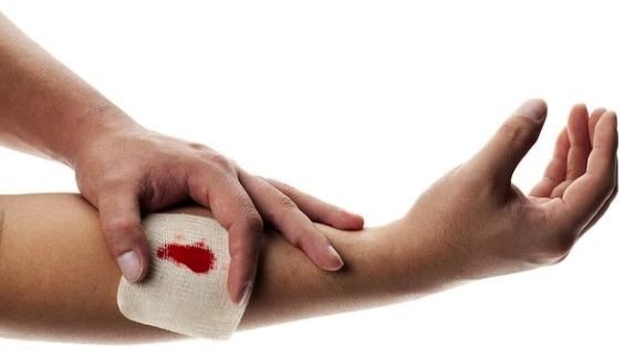 Kraujavimo stabdymas